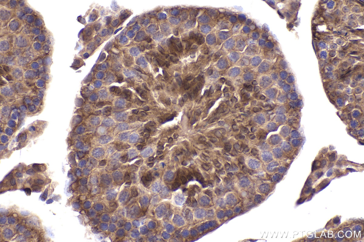 Immunohistochemistry (IHC) staining of mouse testis tissue using PPP3R1 Polyclonal antibody (13210-1-AP)