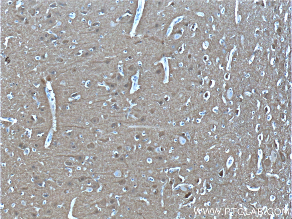 Immunohistochemistry (IHC) staining of human brain tissue using PPP3R1 Polyclonal antibody (13210-1-AP)