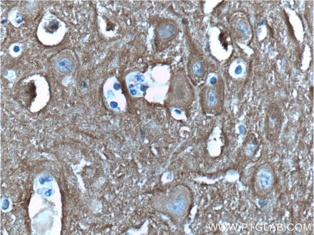 Immunohistochemistry (IHC) staining of human brain tissue using PPP3R1 Polyclonal antibody (13210-1-AP)