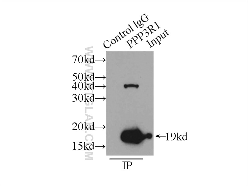 Immunoprecipitation (IP) experiment of HeLa cells using PPP3R1 Polyclonal antibody (13210-1-AP)
