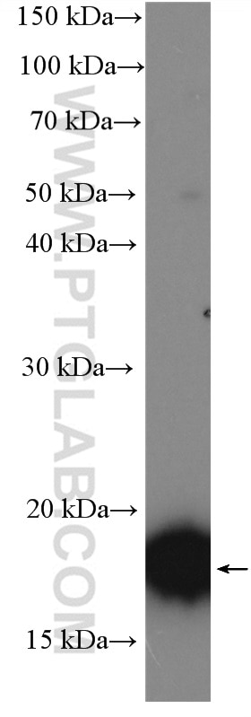 Western Blot (WB) analysis of HeLa cells using PPP3R1 Polyclonal antibody (13210-1-AP)