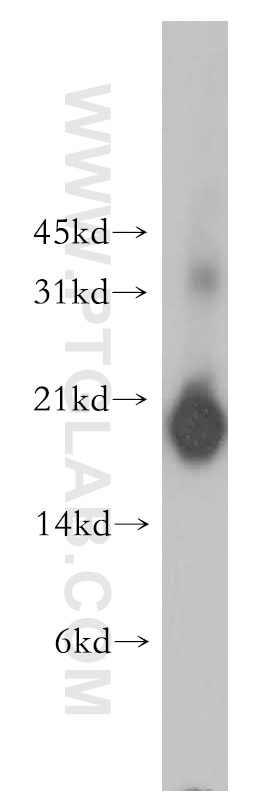 Western Blot (WB) analysis of human stomach tissue using PPP3R1 Polyclonal antibody (13210-1-AP)