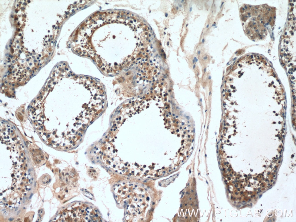 Immunohistochemistry (IHC) staining of human testis tissue using PPP3R2 Polyclonal antibody (14005-1-AP)