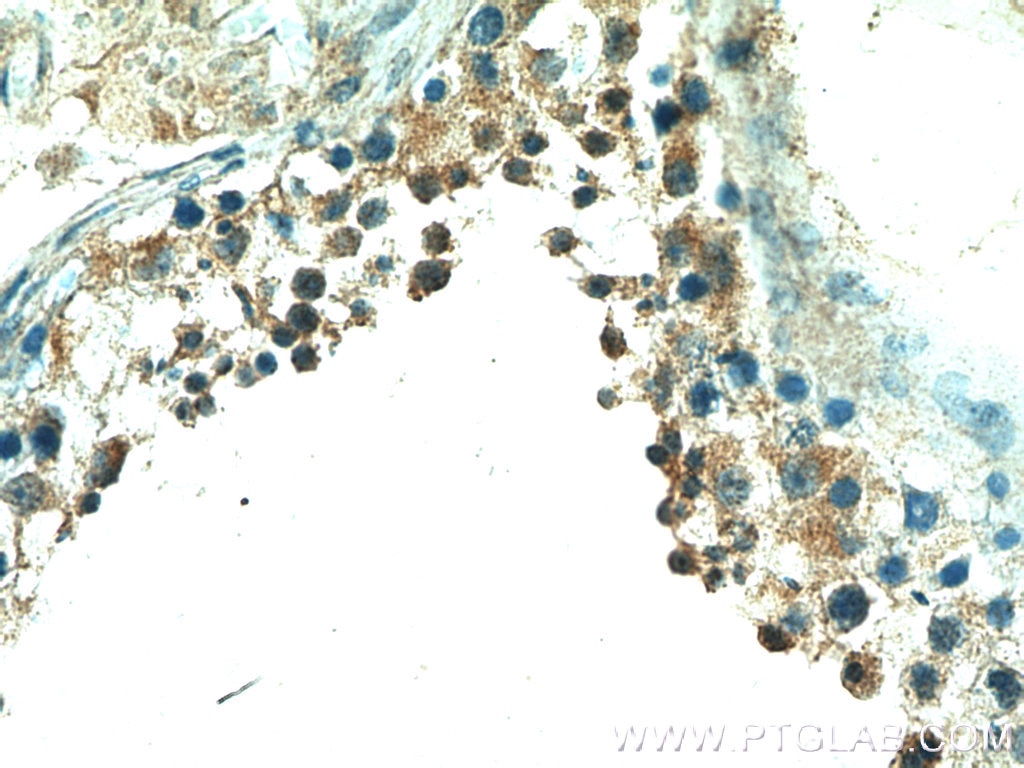 Immunohistochemistry (IHC) staining of human testis tissue using PPP3R2 Polyclonal antibody (14005-1-AP)