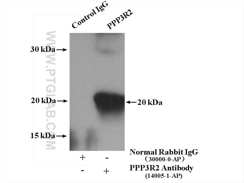 Immunoprecipitation (IP) experiment of mouse testis tissue using PPP3R2 Polyclonal antibody (14005-1-AP)