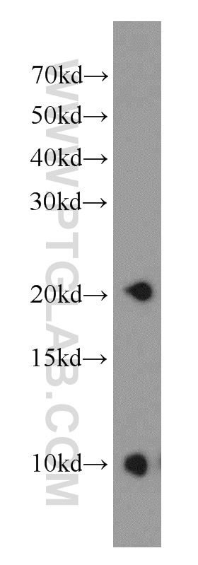 Western Blot (WB) analysis of mouse testis tissue using PPP3R2 Polyclonal antibody (14005-1-AP)