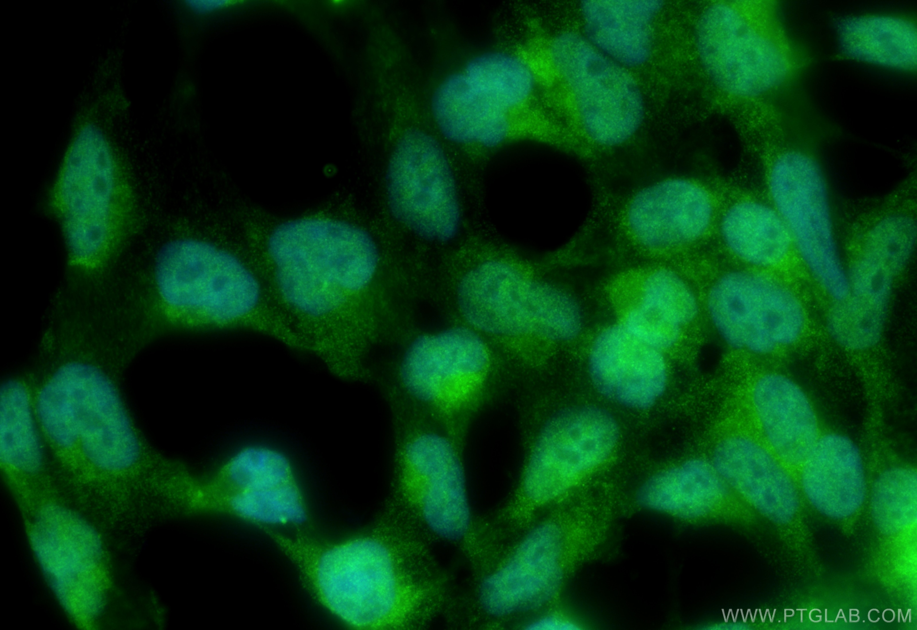 Immunofluorescence (IF) / fluorescent staining of HEK-293 cells using PPP4C Polyclonal antibody (10262-1-AP)