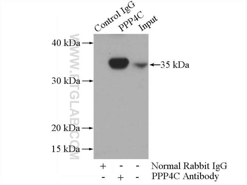 Immunoprecipitation (IP) experiment of mouse kidney tissue using PPP4C Polyclonal antibody (10262-1-AP)