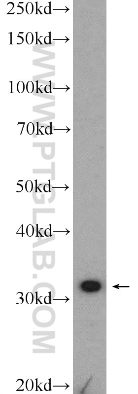 WB analysis of mouse kidney using 10262-1-AP