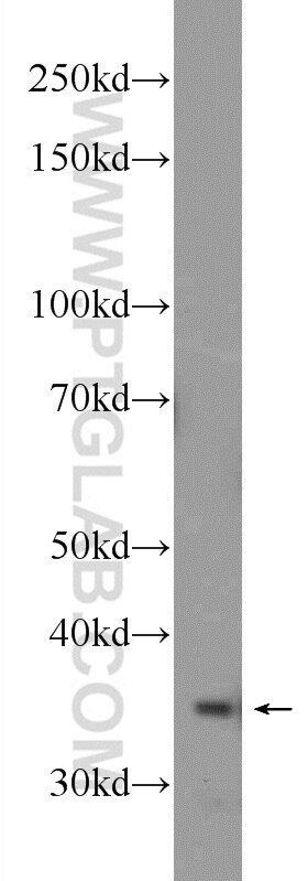 Western Blot (WB) analysis of Jurkat cells using PPP4C Polyclonal antibody (10262-1-AP)