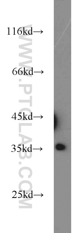 Western Blot (WB) analysis of HEK-293 cells using PPP4C Polyclonal antibody (10262-1-AP)