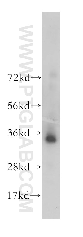 Western Blot (WB) analysis of HEK-293 cells using PPP4C Polyclonal antibody (10262-1-AP)