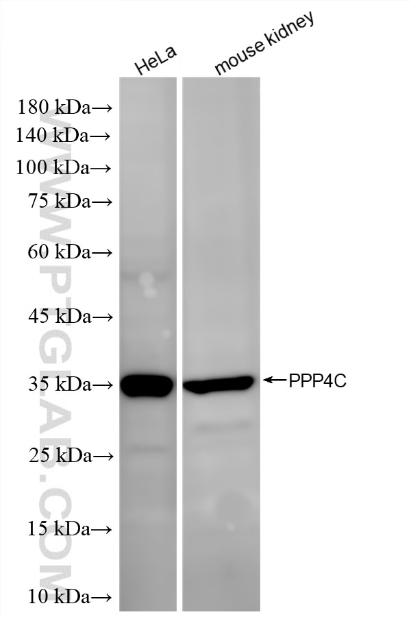 Western Blot (WB) analysis of various lysates using PPP4C Recombinant monoclonal antibody (86600-3-RR)