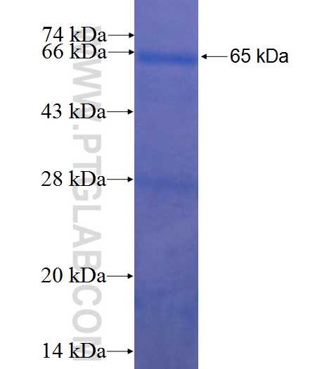 PPP4C fusion protein Ag0356 SDS-PAGE