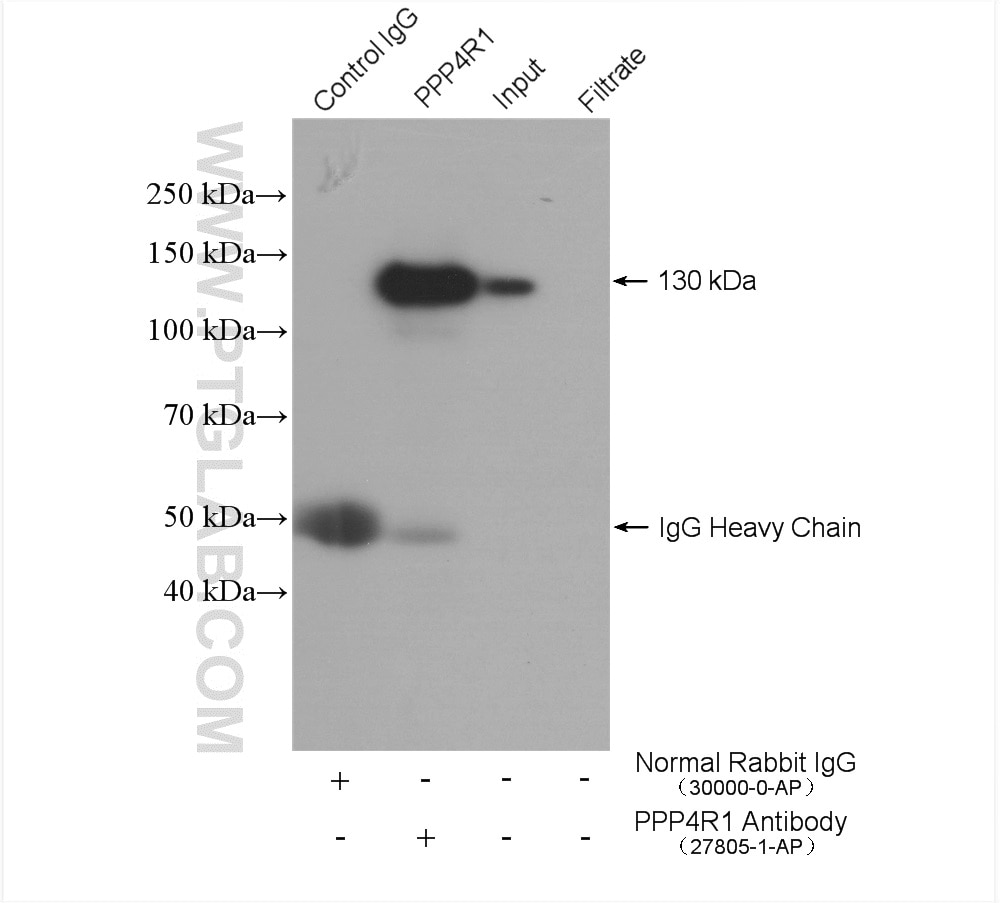 Immunoprecipitation (IP) experiment of HEK-293T cells using PPP4R1 Polyclonal antibody (27805-1-AP)