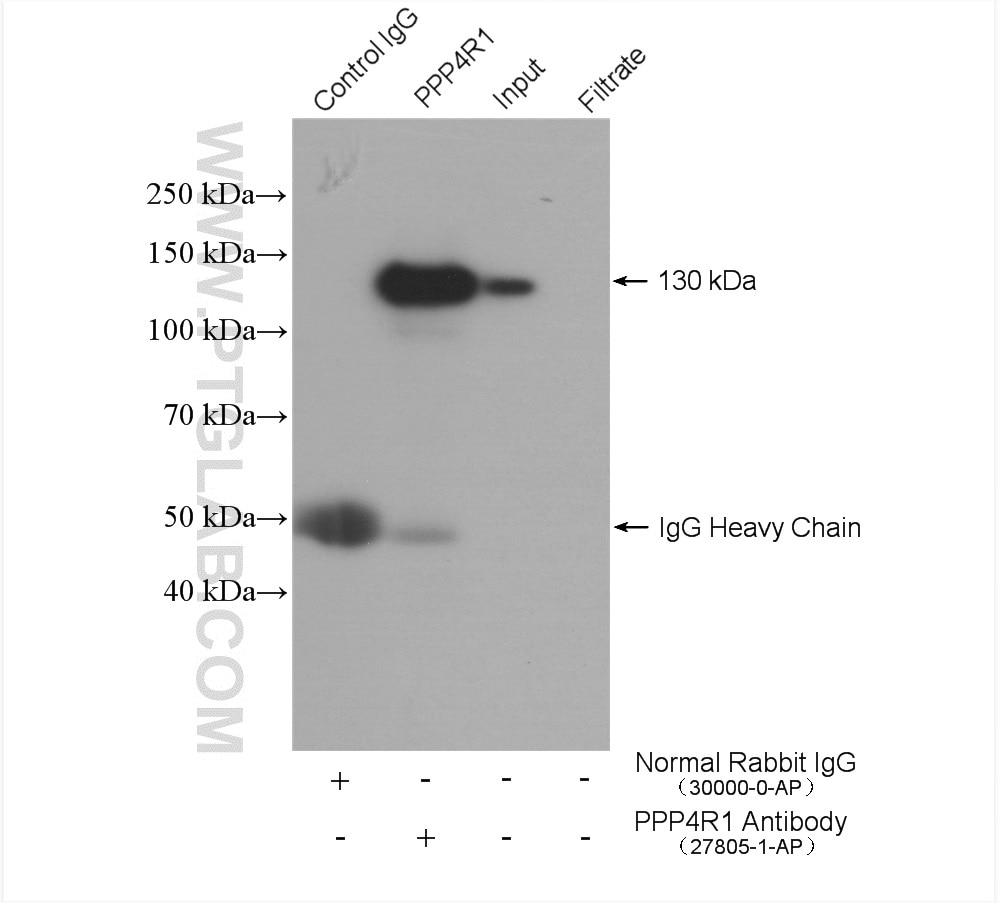 IP experiment of HEK-293T using 27805-1-AP