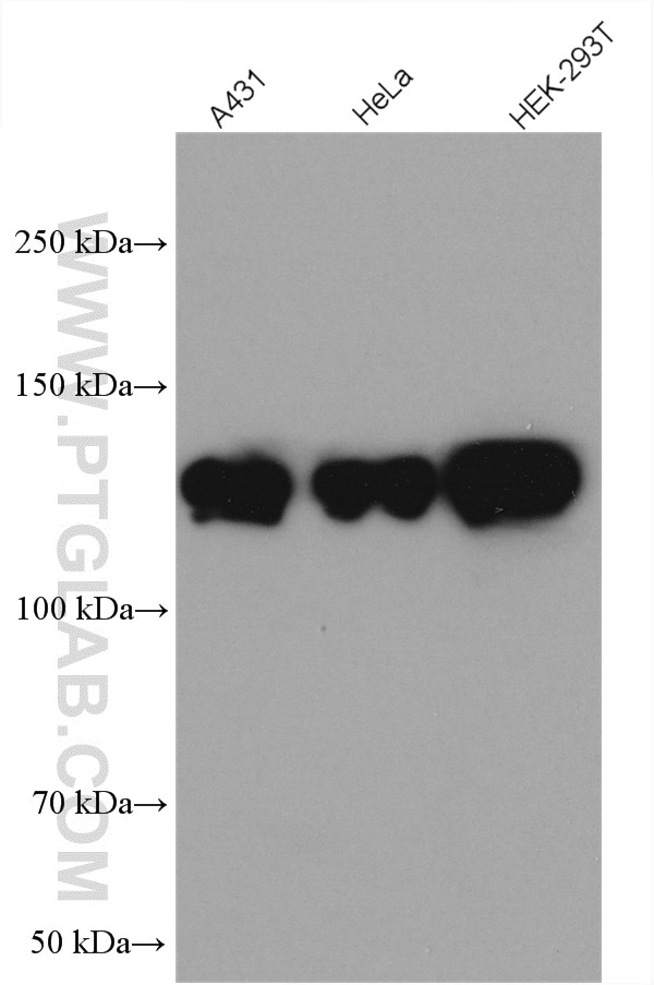 Western Blot (WB) analysis of various lysates using PPP4R1 Polyclonal antibody (27805-1-AP)