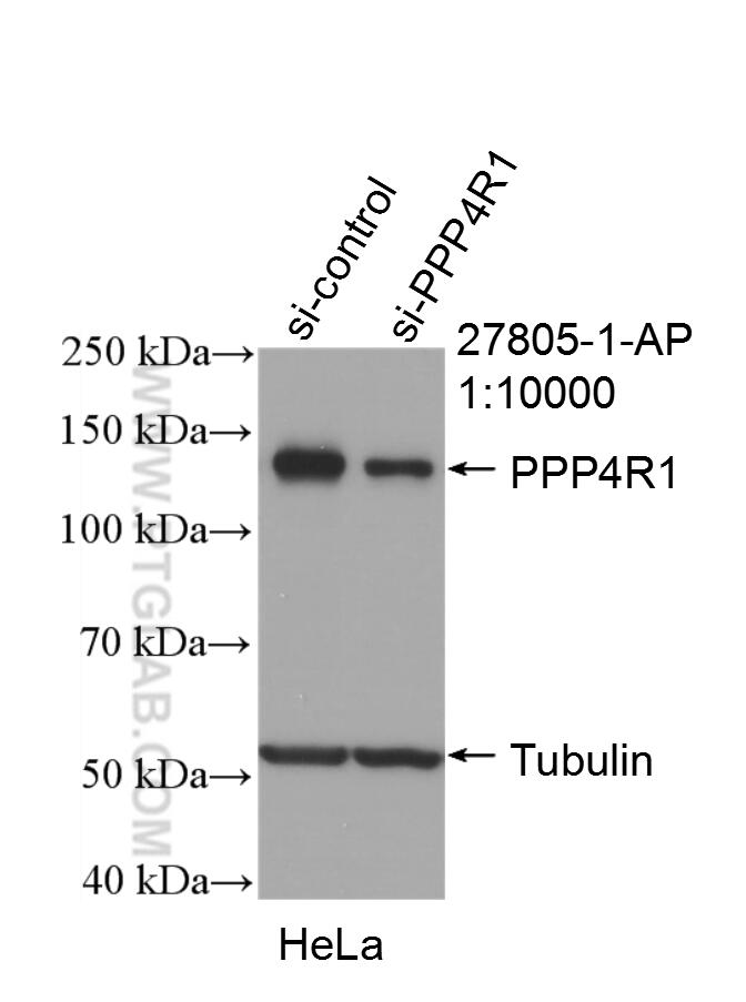 Western Blot (WB) analysis of HeLa cells using PPP4R1 Polyclonal antibody (27805-1-AP)