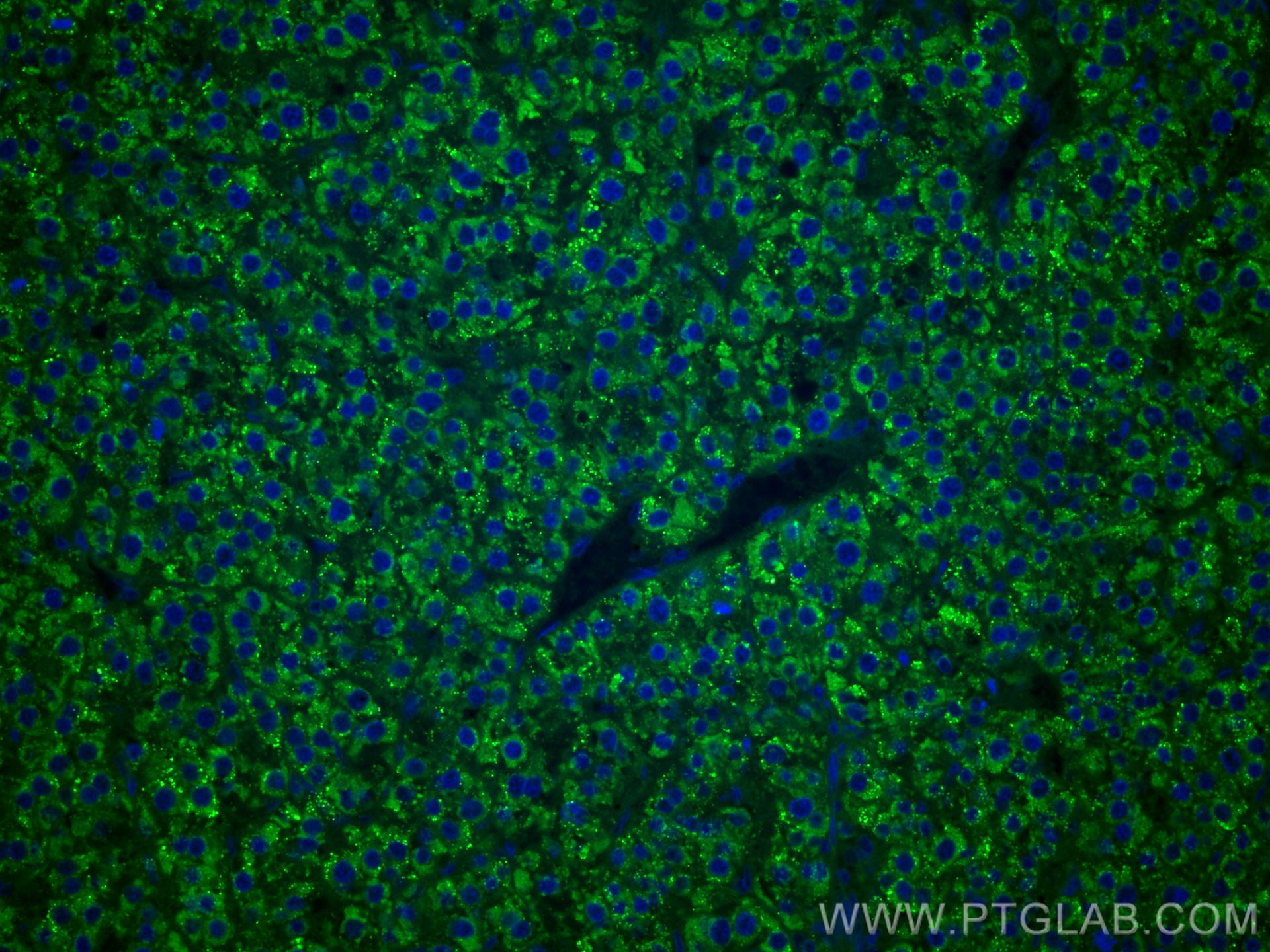 IF Staining of human liver cancer using CL488-67392