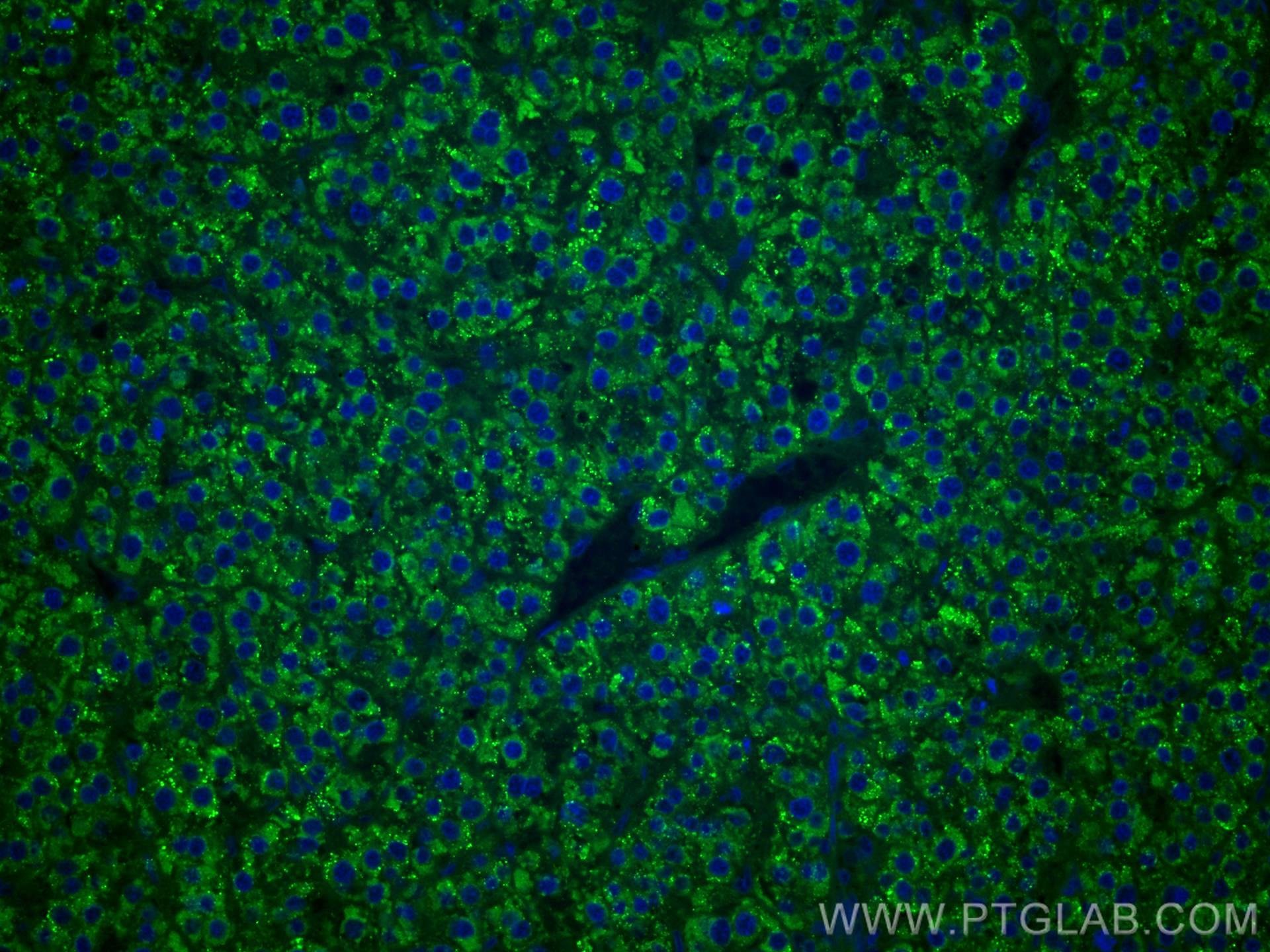 Immunofluorescence (IF) / fluorescent staining of human liver cancer tissue using CoraLite® Plus 488-conjugated PPP4R1 Monoclonal an (CL488-67392)