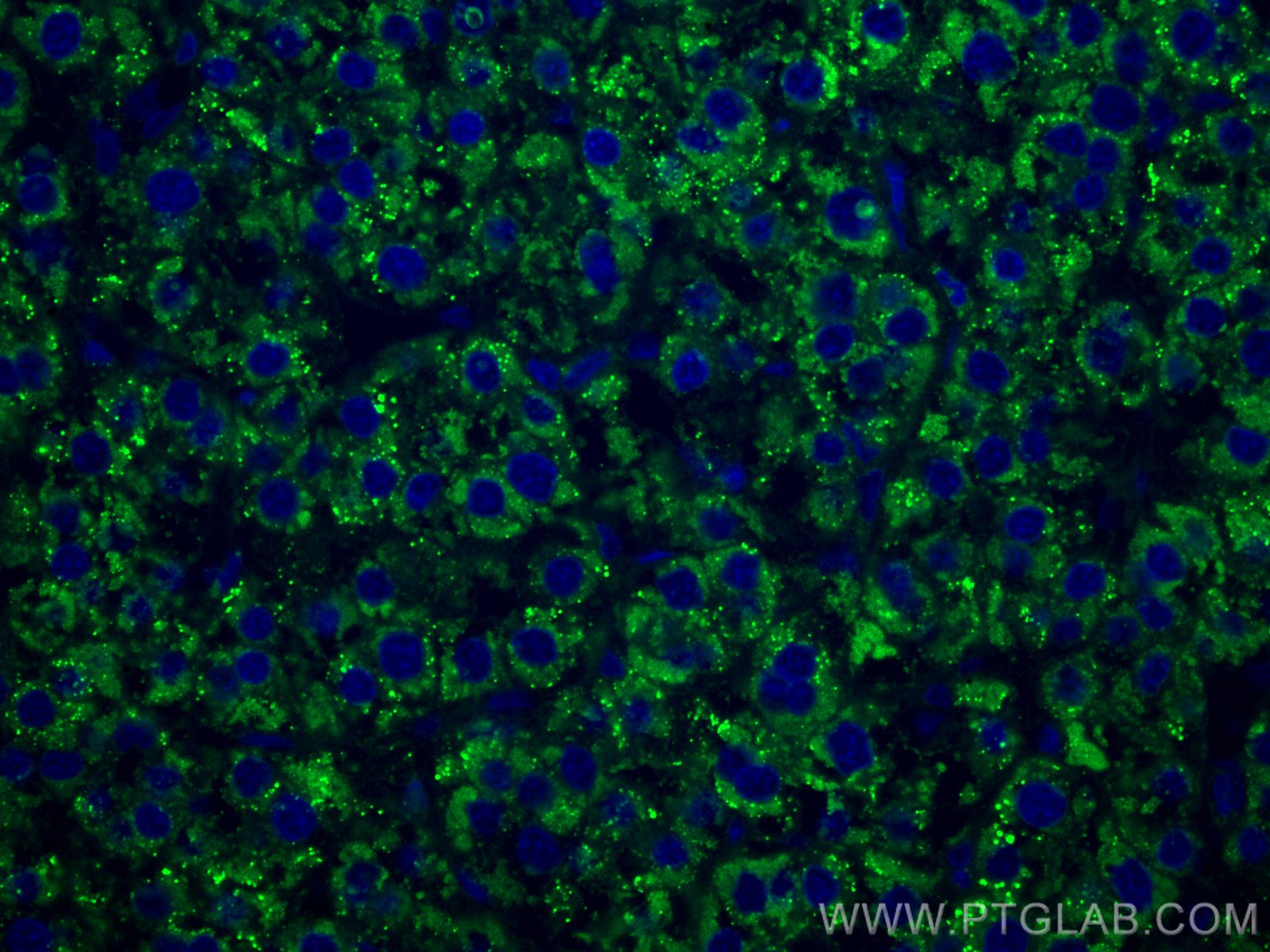 Immunofluorescence (IF) / fluorescent staining of human liver cancer tissue using CoraLite® Plus 488-conjugated PPP4R1 Monoclonal an (CL488-67392)