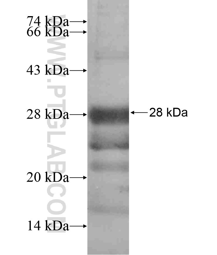 PPP4R1L fusion protein Ag17282 SDS-PAGE