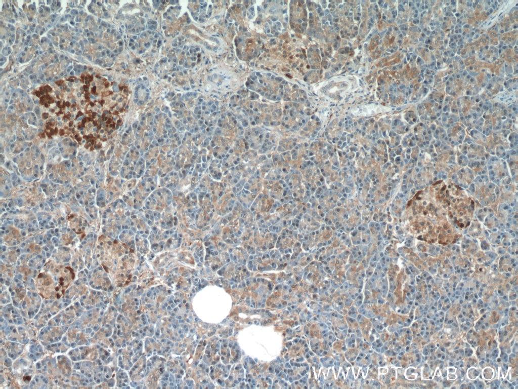 Immunohistochemistry (IHC) staining of human pancreas tissue using PPP4R2 Polyclonal antibody (22676-1-AP)