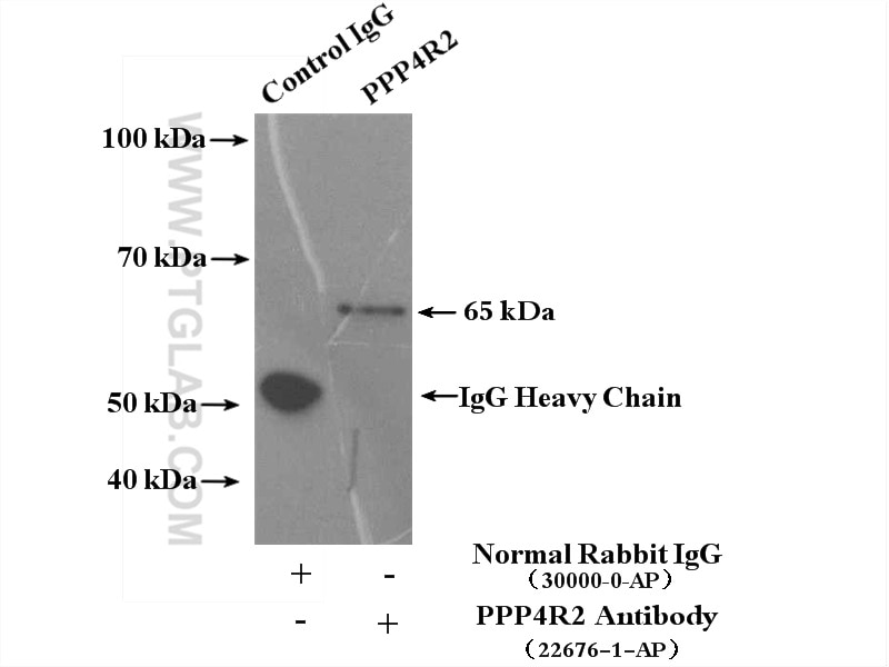 Immunoprecipitation (IP) experiment of HepG2 cells using PPP4R2 Polyclonal antibody (22676-1-AP)