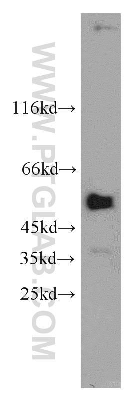 Western Blot (WB) analysis of A549 cells using PPP4R2 Polyclonal antibody (22676-1-AP)