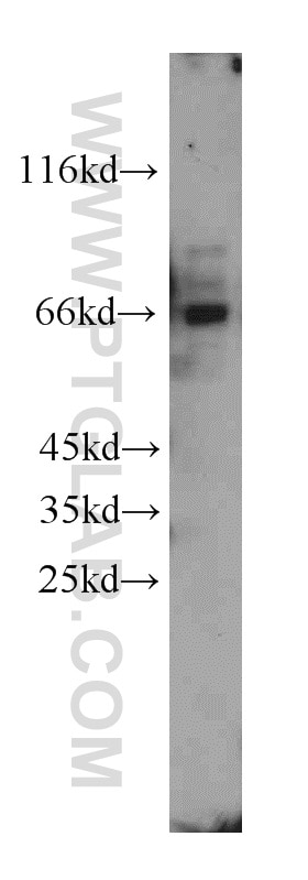 Western Blot (WB) analysis of HepG2 cells using PPP4R2 Polyclonal antibody (22676-1-AP)