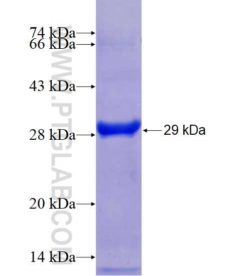 PPP4R2 fusion protein Ag18165 SDS-PAGE