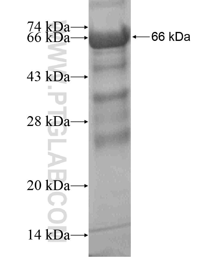 PPP4R2 fusion protein Ag18486 SDS-PAGE