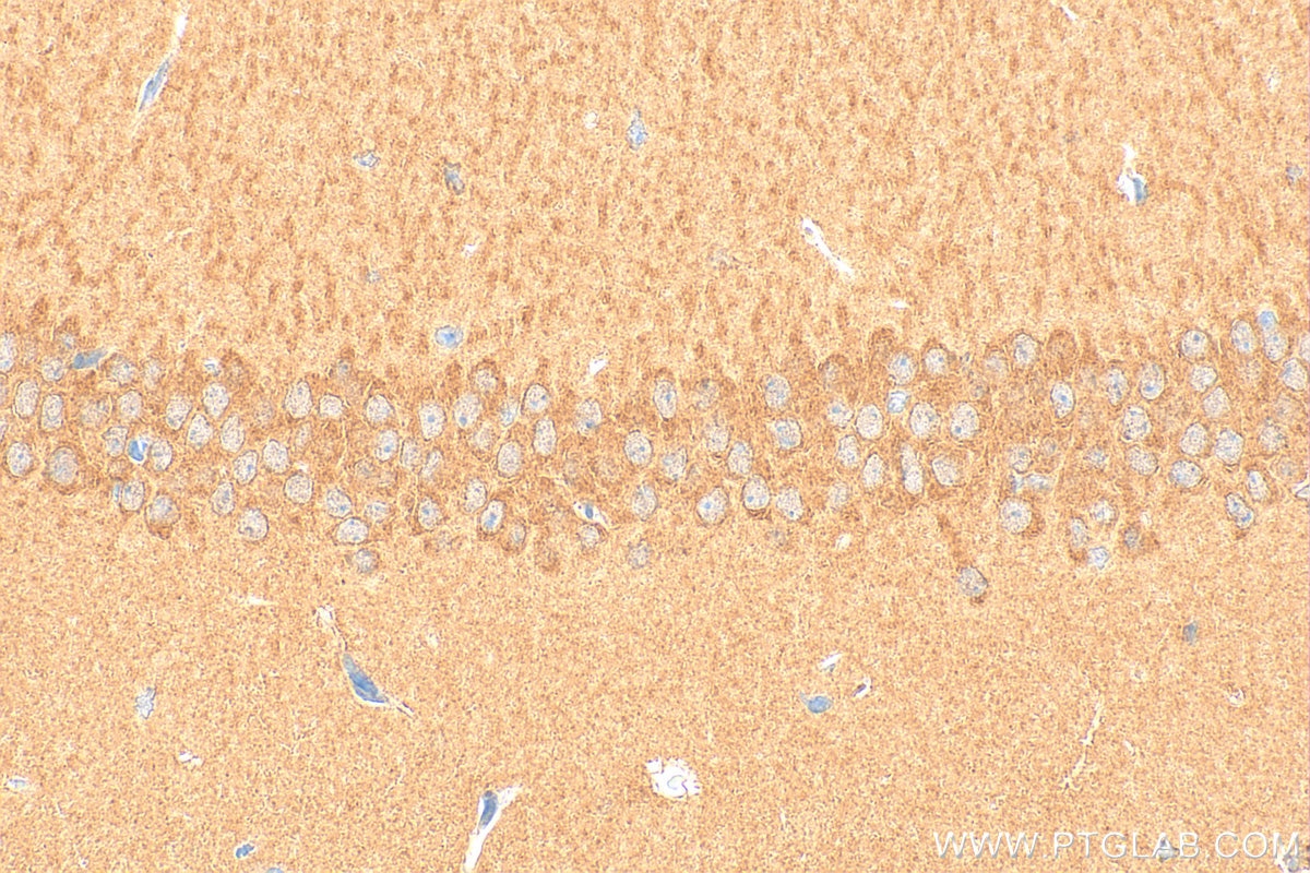 Immunohistochemistry (IHC) staining of mouse brain tissue using PP4R4 Polyclonal antibody (20124-1-AP)