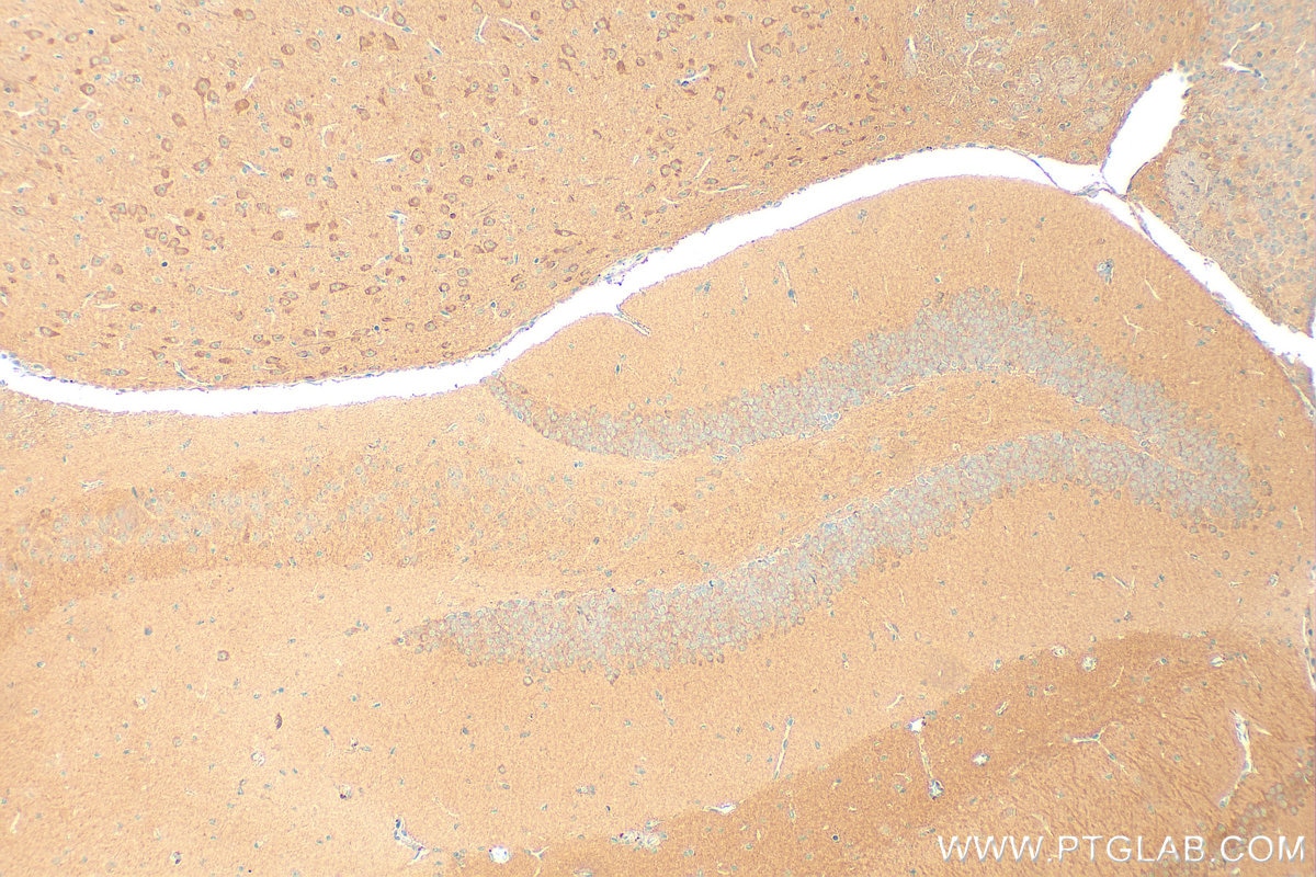 Immunohistochemistry (IHC) staining of mouse brain tissue using PP4R4 Polyclonal antibody (20124-1-AP)