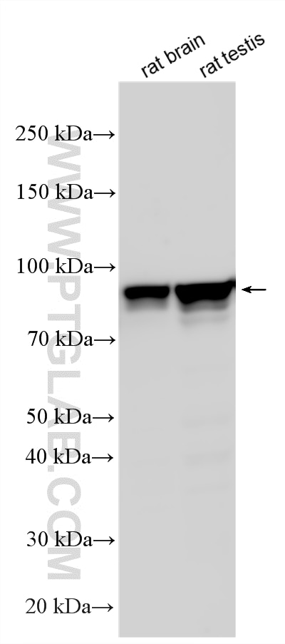 Western Blot (WB) analysis of various lysates using PP4R4 Polyclonal antibody (20124-1-AP)