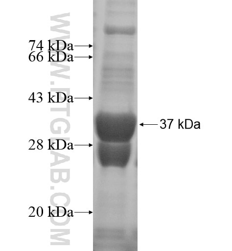PPP4R4 fusion protein Ag13868 SDS-PAGE