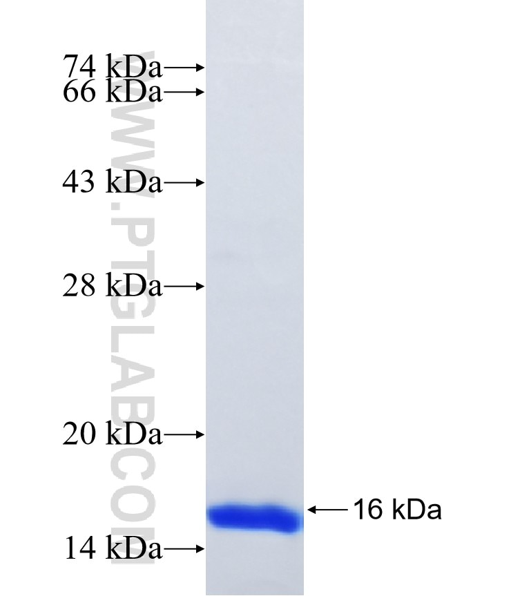 PPP4R4 fusion protein Ag17100 SDS-PAGE