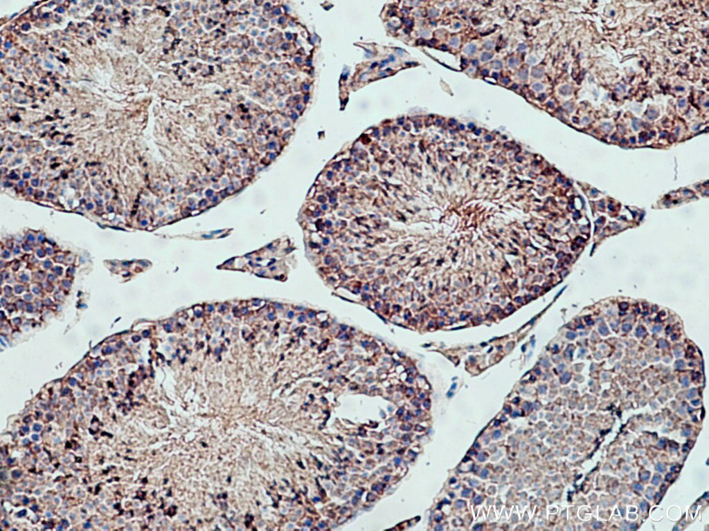 Immunohistochemistry (IHC) staining of mouse testis tissue using PPP6C Polyclonal antibody (15852-1-AP)