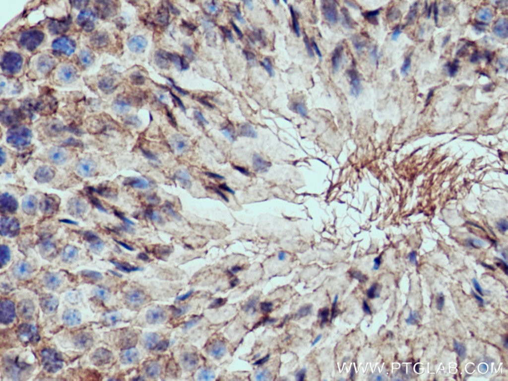 Immunohistochemistry (IHC) staining of mouse testis tissue using PPP6C Polyclonal antibody (15852-1-AP)