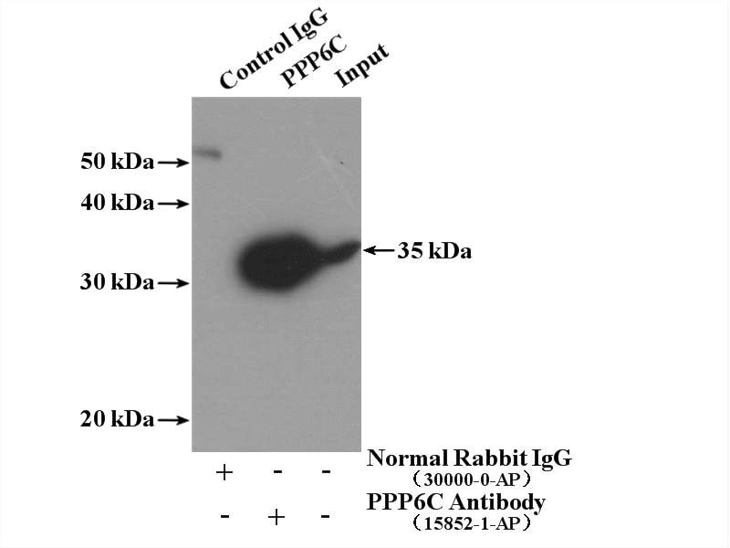 Immunoprecipitation (IP) experiment of mouse testis tissue using PPP6C Polyclonal antibody (15852-1-AP)
