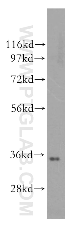 Western Blot (WB) analysis of HEK-293 cells using PPP6C Polyclonal antibody (15852-1-AP)