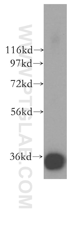 Western Blot (WB) analysis of human testis tissue using PPP6C Polyclonal antibody (15852-1-AP)