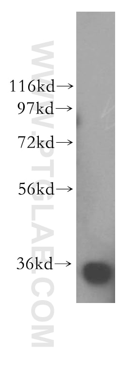 Western Blot (WB) analysis of NIH/3T3 cells using PPP6C Polyclonal antibody (15852-1-AP)