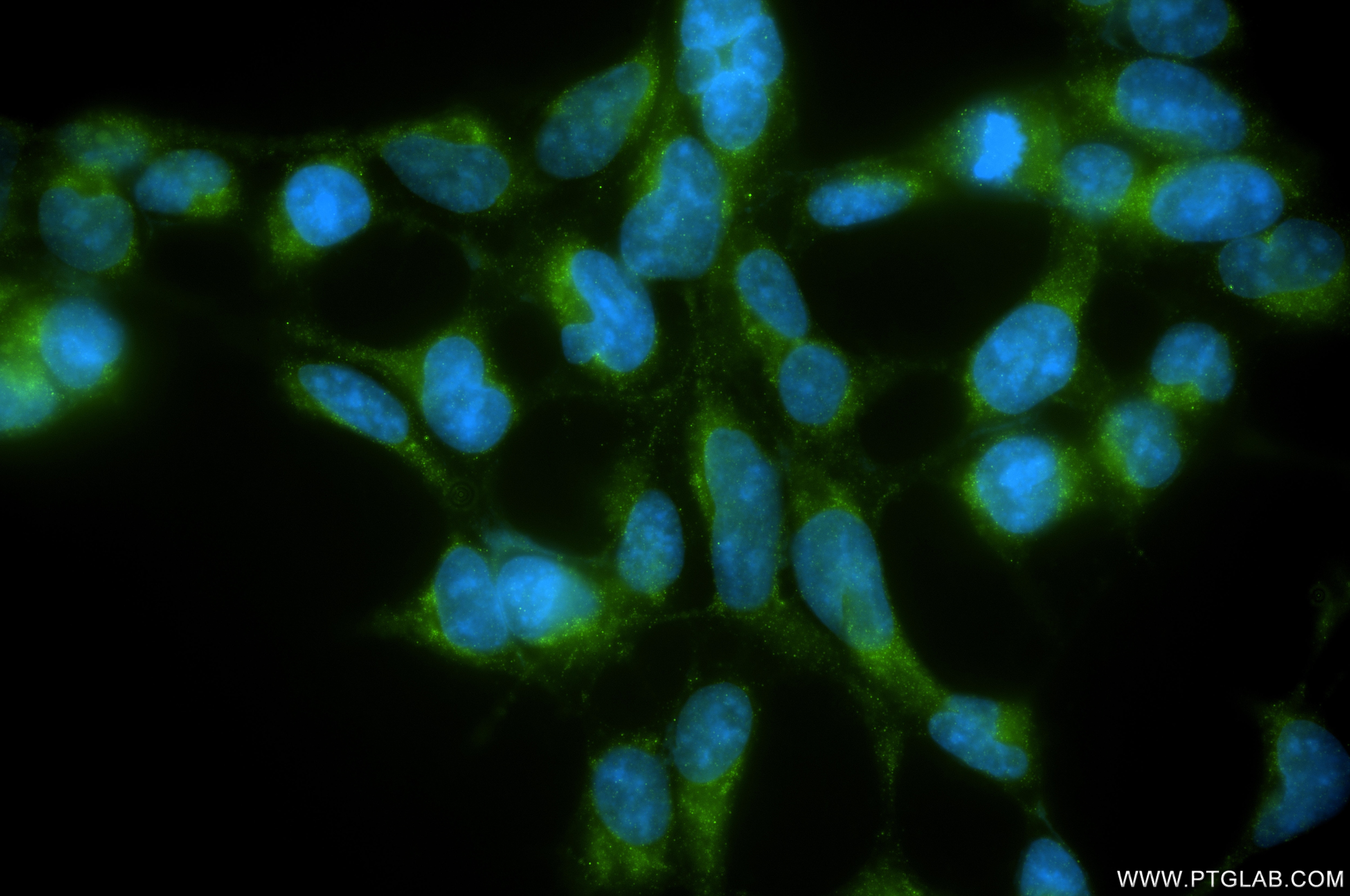 IF Staining of HEK-293 using 87155-1-RR Immunofluorescence (IF) / fluorescent staining of HEK-293 cells using PPP6C Recombinant monoclonal antibody (87155-1-RR)