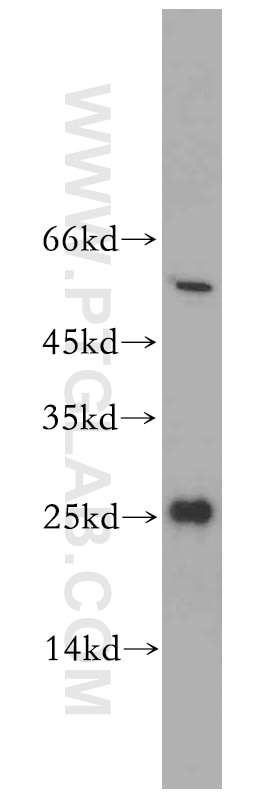 Western Blot (WB) analysis of A549 cells using PPPDE1/PNAS4 Polyclonal antibody (20517-1-AP)