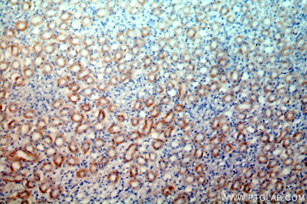 Immunohistochemistry (IHC) staining of human kidney tissue using PPT1 Polyclonal antibody (10887-1-AP)