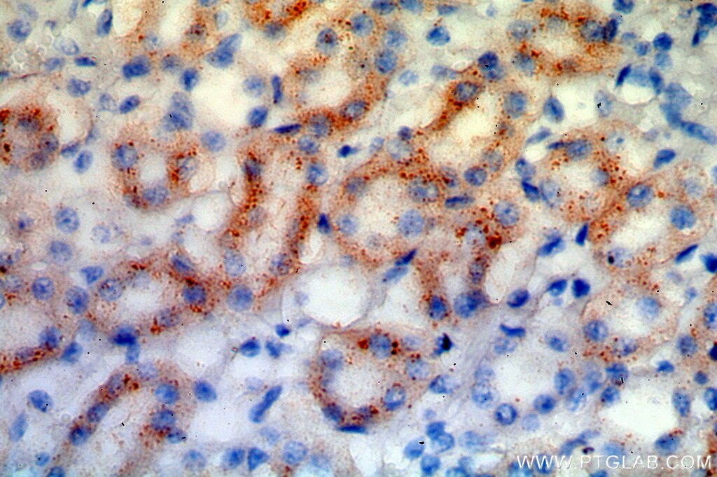 Immunohistochemistry (IHC) staining of human kidney tissue using PPT1 Polyclonal antibody (10887-1-AP)