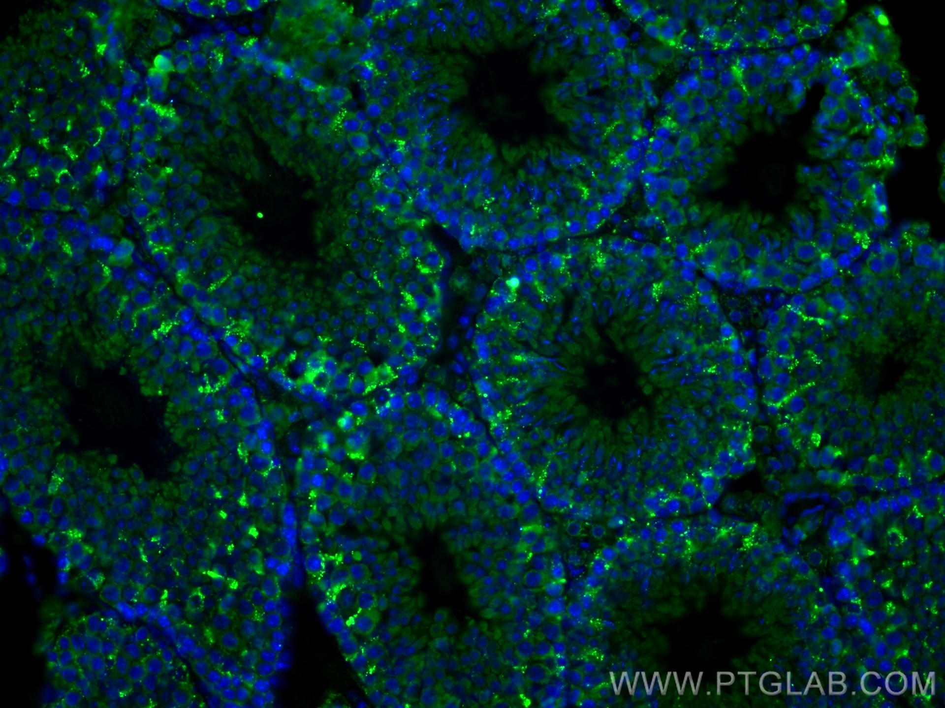 Immunofluorescence (IF) / fluorescent staining of mouse testis tissue using PPT1 Polyclonal antibody (29653-1-AP)