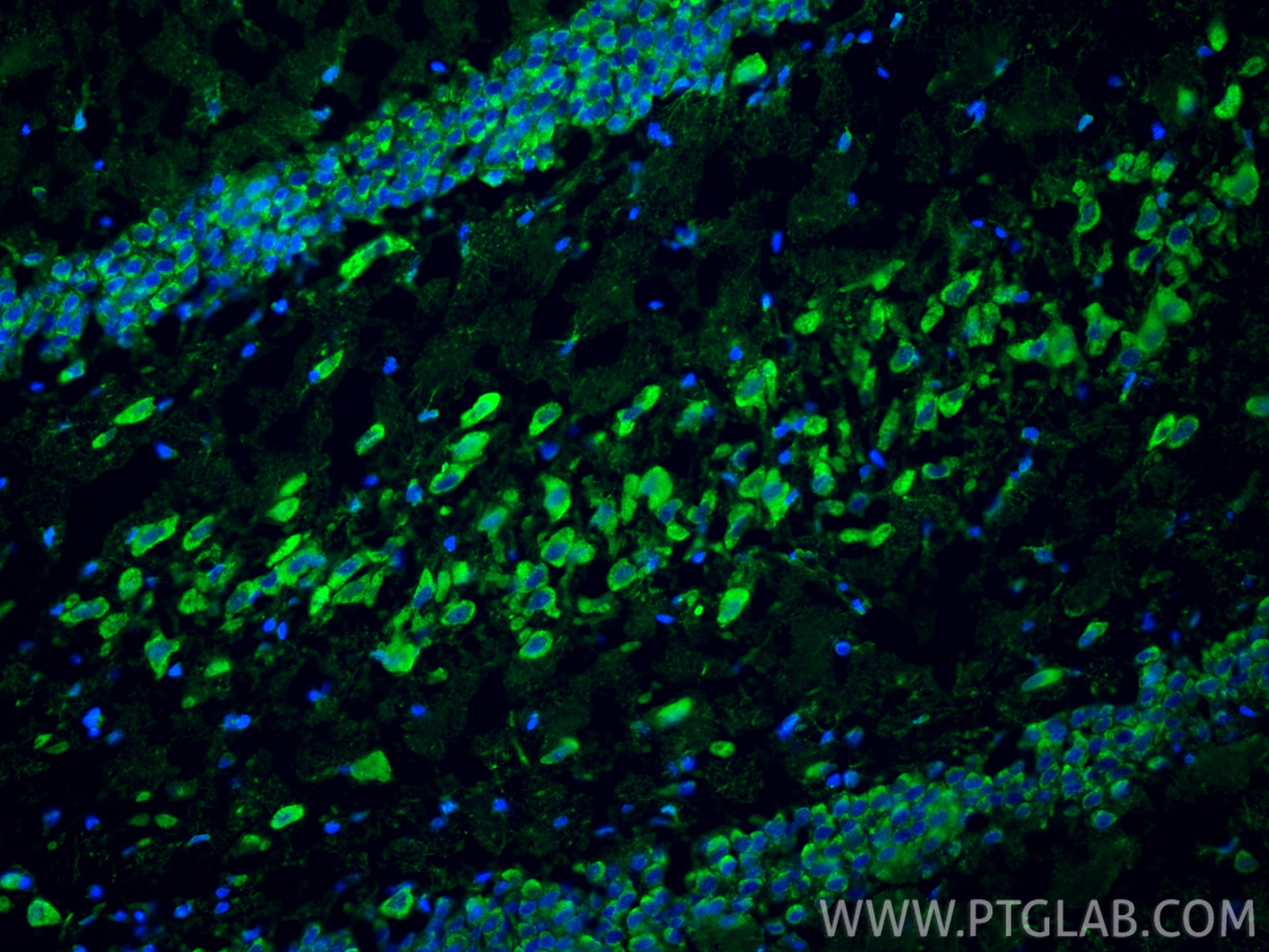 Immunofluorescence (IF) / fluorescent staining of rat brain tissue using PPT1 Polyclonal antibody (29653-1-AP)