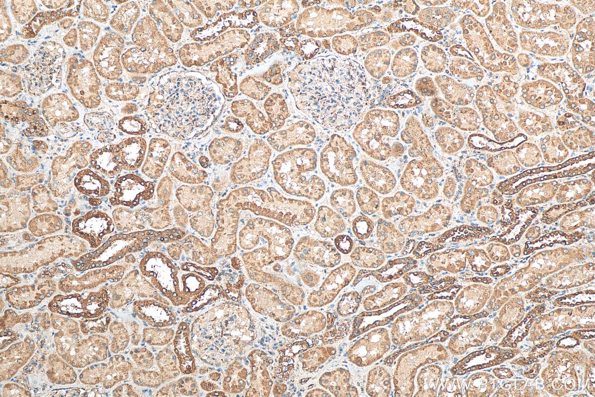 Immunohistochemistry (IHC) staining of human kidney tissue using PPT1 Polyclonal antibody (29653-1-AP)